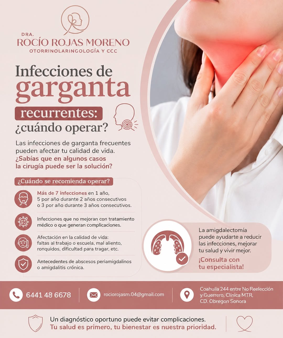 Infografía sobre cuándo se recomienda la amigdalectomía