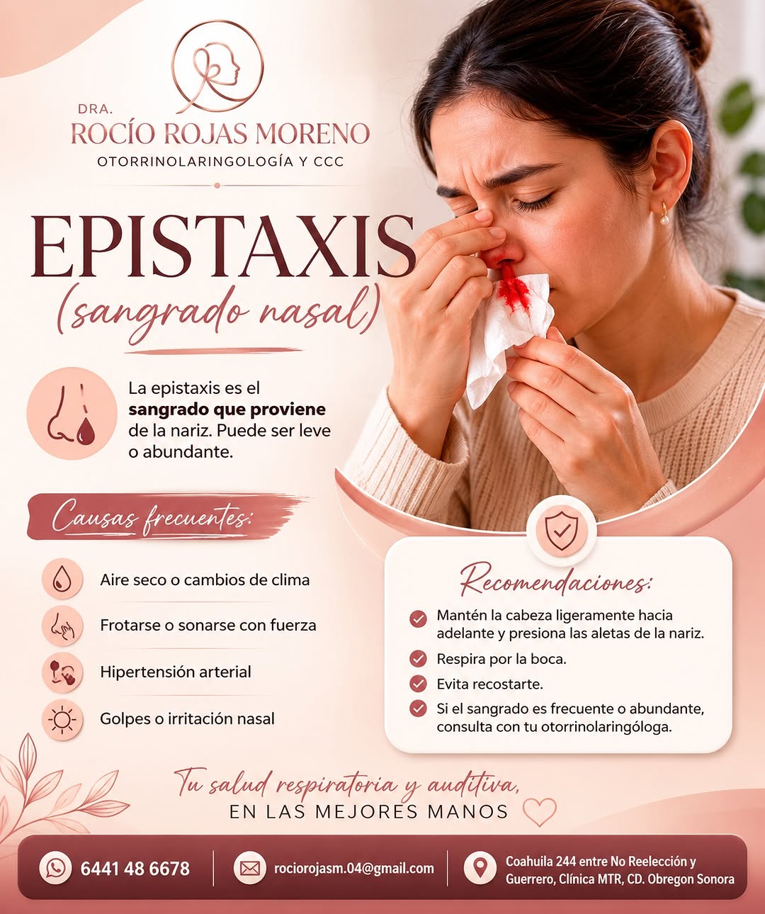 Infografía sobre epistaxis o sangrado nasal